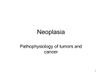 Neoplasia