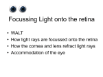 Focussing_Light_onto..