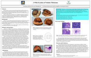 A Wide Excision of Nodular Melanoma