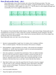 Sinus_Bradycardia