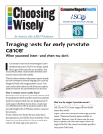 Imaging tests for early prostate cancer