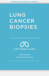 lung cancer biopsies - Lung Cancer Alliance
