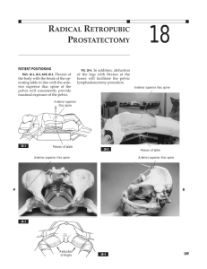 RADICAL RETROPUBIC PROSTATECTOMY