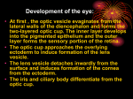 Development of the eye: