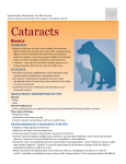 Cataract