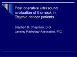 US images of clustered malignant lymph nodes at