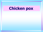 Chicken pox