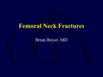 Femoral Neck Fractures