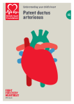 Patent ductus arteriosus - British Heart Foundation