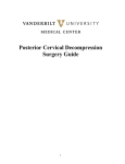 Posterior Cervical Decompression Surgery Guide