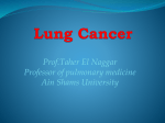 Lung Cancer - Ain Shams University