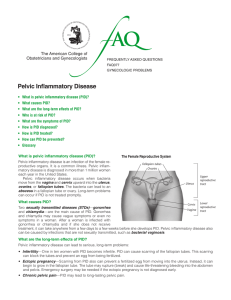 FAQ077 -- Pelvic Inflammatory Disease