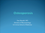 Osteoporosis - UC Irvine`s Department of Medicine