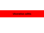 Ulcerative colitis