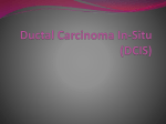 Ductal Carcinoma In-Situ (DCIS)