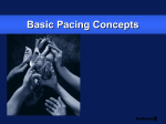 Basic Pacing Concepts