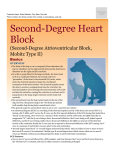 second-degree_heart_block_(mobitz_ii)
