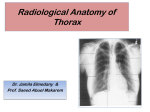 5-Radiological_Anatomy_of_Thorax2016-01-18 08
