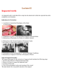 Lecture12 Impacted teeth: An impacted tooth is tooth that fail to erupt