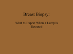 What Is A Biopsy? - Sisters Network Inc.