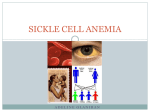 sickle cell anemia - Sickle Cell Ministries