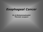 Esophageal Cancer