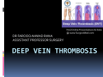 deep vein thrombosis