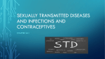 Sexually Transmitted diseases and infections