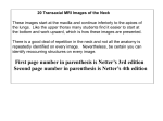 Neck: MRI axial sections