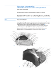 Living Donor Transplantation: Left Hemiliver Donor Procedure and