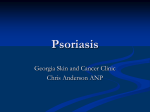 Psoriasis - Georgia Skin and Cancer Clinic