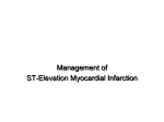 ST Elevation Myocardial Infarction