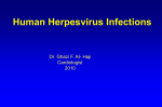 Epstein Barr virus (EBV)