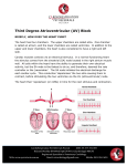 Third Degree Atrioventricular Block Explained