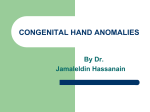 congenital hand anomalies
