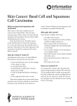 Skin Cancer: Basal Cell and Squamous Cell Carcinoma