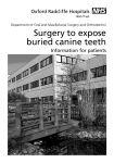 Surgery to expose buried canine teeth