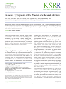 Bilateral Hypoplasia of the Medial and Lateral Menisci