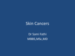 Skin Cancers
