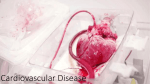 Cardiovascular as a Chronic Disease