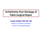 Arryhythmias post-TOF repair surgical repair
