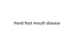 Hand foot mouth disease
