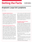Anaplastic Large Cell Lymphoma
