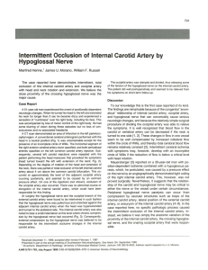 Intermittent Occlusion of Internal Carotid Artery by Hypoglossal Nerve