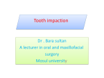 Tooth impaction
