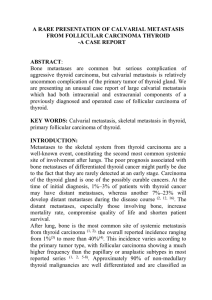 a rare presentation of calvarial metastasis from follicular carcinoma