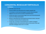 Torticolliss means twist neck. The neck is tilted to one side and the