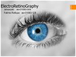 ElectroRetinoGraphy - Engr. Ijlal Haider