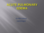 Acute pulmonary edema