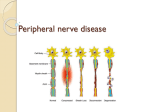 MOTOR NEURON DISEASE